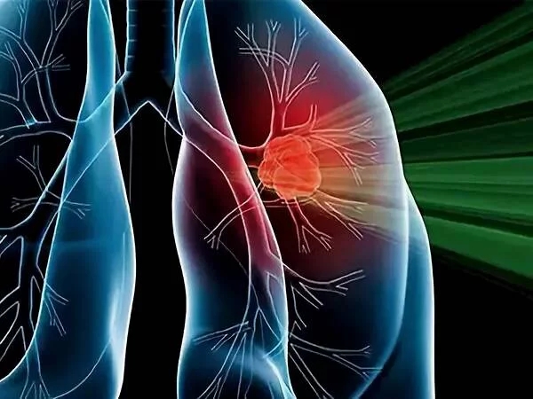 1614045798897487.jpg t01509d3ed79b62c844.webp.jpg